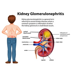 Medical Infographic Kidney Glomerulosclerosis