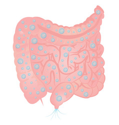 Bloating And Excess Gas In Intestine