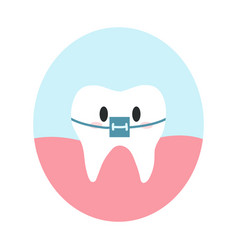 Cute Healthy Tooth With Braces In Cartoon Flat