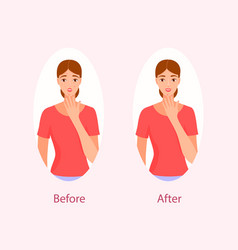 Acne Treatment Before After Cartoon