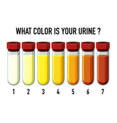 Urine Color Chart