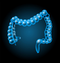 Large Intestine Parts Of Bowel Cecum