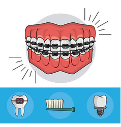 Dental Braces Elements