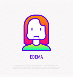 Edema Thin Line Icon Woman With Swollen Cheeks