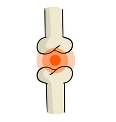 Arthritis Disease Of Joints Bones