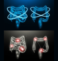 Polygonal Of An Inflamed Human Intestine