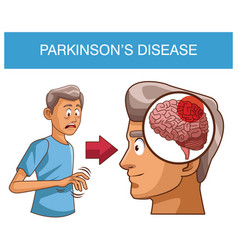 Parkinsons Disease Cartoon