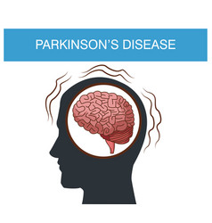 Parkinsons Disease Cartoon