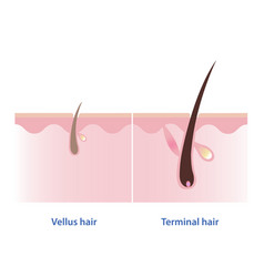 Vellus And Terminal Hair