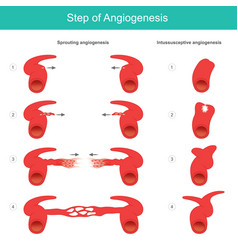 Step Of Angiogenesis Medical Learning About