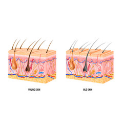 Young Old Skin Structure