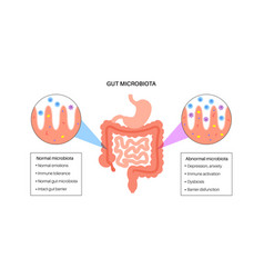 Human Gut Microbiota