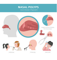 Nasal Diseases Polyps Causes Diagnosis