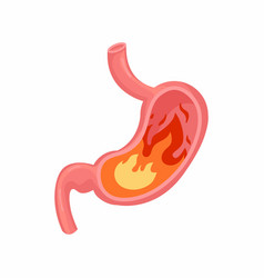 Heartburn In The Stomach Unhealthy Stomach Concept