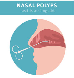 Nasal Diseases Polyps Causes Diagnosis