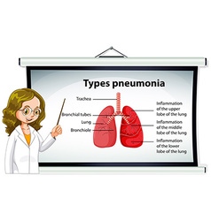 Doctor Explaining Types Of Pneumonia