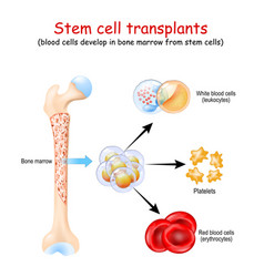 Stem Cell Transplants