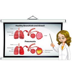 Doctor Explaining Healthy Bronchiole And Alveoli