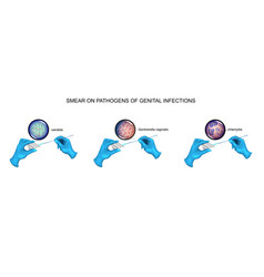 Smear Candidiasis Vaginosis Chlamydia