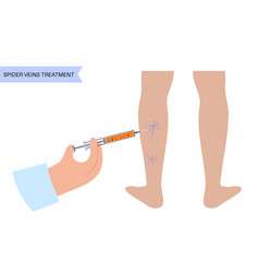 Varicose Injection Procedure