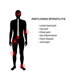 Ankylosing Spondylitis Disease