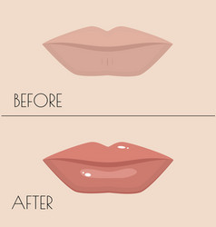 Permanent Makeup Of Lips Before And After