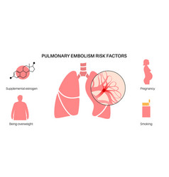 Pulmonary Embolism Disease