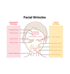 Expression Wrinkles And Aging Female