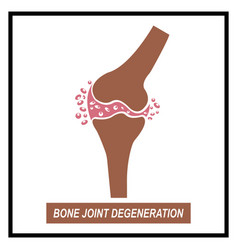 Bone Joint Degeneration Icon