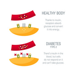 Diabetes Type 2 Concept In Flat Style