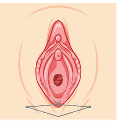 Vaginal Lifting With Threads Female Reproductive