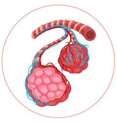 Diagram Of Sickness In Human Lungs