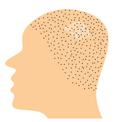 Fungal Infection On Scalp