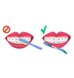 Instructions To Rule Of Right False Brush Teeth