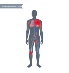 Pulmonary Embolism Disease