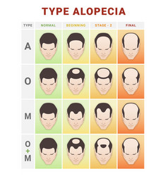 Hair Loss Stages Infographic Medical Education