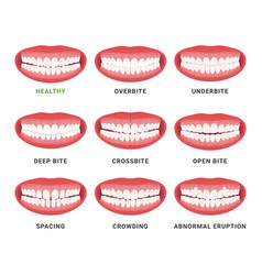 Human Mouth Jaws Medical Bad Bite And Healthy