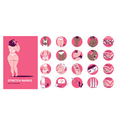 Stretch Marks Round Icons