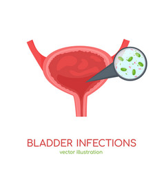 Bladder Infections Icon Editable