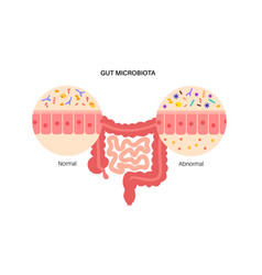 Human Gut Microbiota