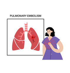 Pulmonary Embolism Disease