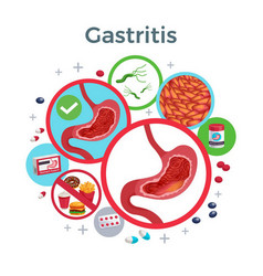 Gastritis Disease Symptoms Causes Medicine Flat