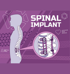 Spinal Implant Medical