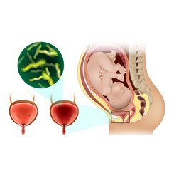 Uti Or Urinary Tract Infection During Pregnancy