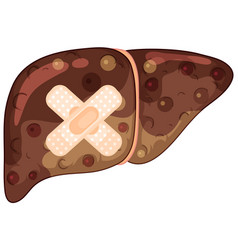 Fibrosis Liver With Cross Plasters On White