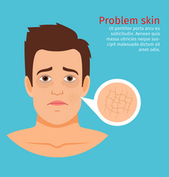 Young Man Face Dry Skin Problem