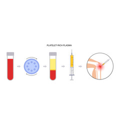 Platelet Rich Plasma Concept