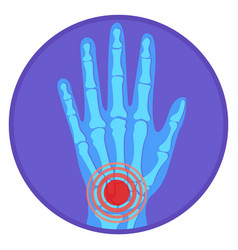 Wrist Pain Icon Round Hand Ache Symbol