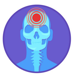 Headache Round Icon Migraine Symbol Head Pain