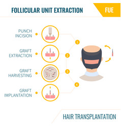 Hair Transplantation Fue Method In Men